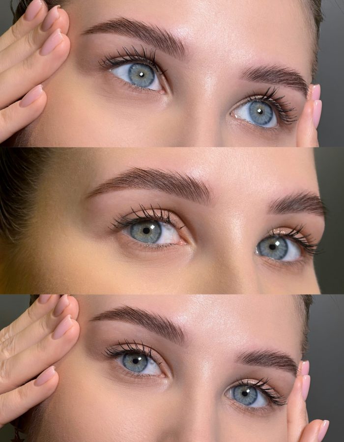 Brow-lift with tinting